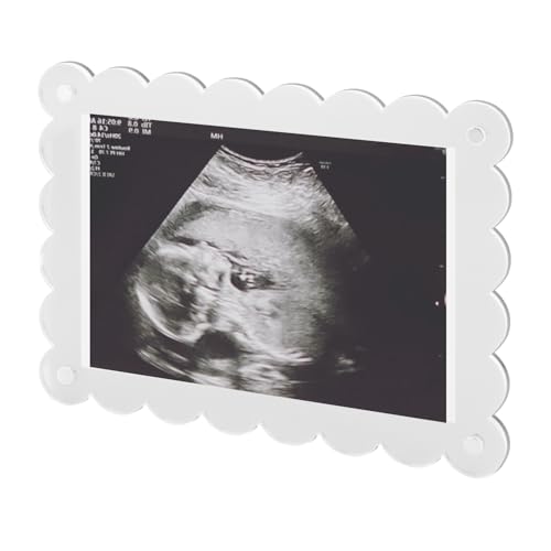 BOXOB Gewellter Magnetischer Bilderrahmen Acryl, 18x13cm Fotorahmen zur Schwangerschaftsankündigung Andenken zur Bekanntgabe des Geschlechts Geschenk für Werdende Eltern (Transparent) von BOXOB
