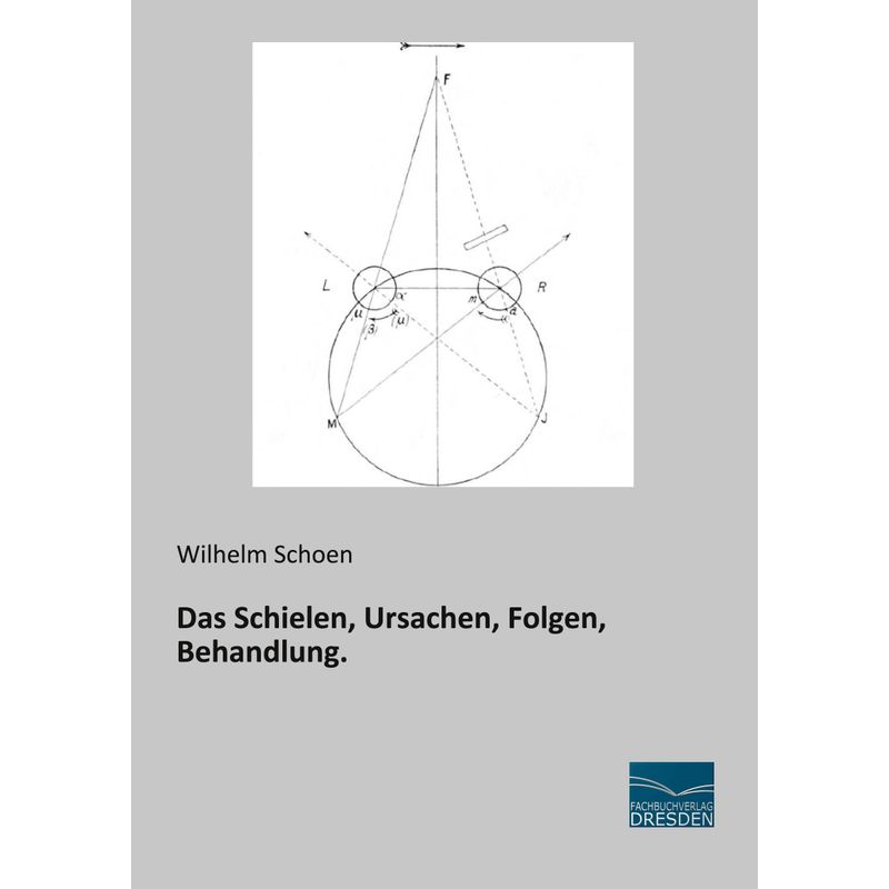 Das Schielen, Ursachen, Folgen, Behandlung. - Wilhelm Schoen, Kartoniert (TB) von Fachbuchverlag-Dresden