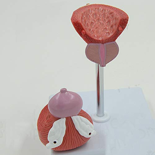 Anatomisches Modell der Blase – Anatomisches Modell menschlicher Organe. Anatomisches Modell der männlichen Prostata und Anatomisches Modell der Blase – Anatomisches Modell menschlicher Organe. Anatomisches Modell der männlichen Prostata und von Generic