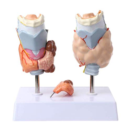 Anatomisches Modell der menschlichen Schilddrüsenpathologie – das Hals-Schilddrüsen-Schilddrüsenzystentumor-Modell, das von Generic