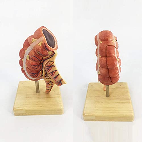 Bildungsmodell Anatomisches Modell des menschlichen Körpers Blinddarm Anhang Aufsteigendes Ileum-Gefäß-Lymph-Modell, med von Generic