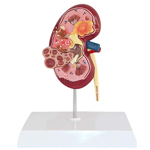 Bildungsmodell Menschliche Niere Anatomisches Modell Medizinisches anatomisches Nierenmodell Menschliches Organ Medizin von Generic
