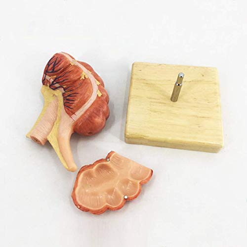 Lehrmodell Anatomisches Modell des menschlichen Ileozökal-Blinddarm-Anhangs Aufsteigendes Ileum-Gefäß-Lymph-Modell, med von Generic