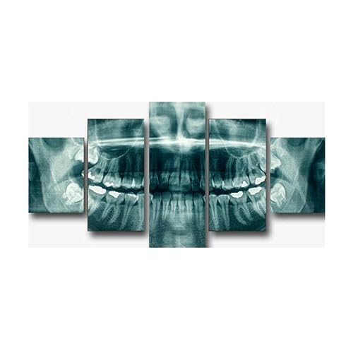 Leinwand-Malerei 5 Stück - Zahnzähne Röntgen-Zahnarzt - Wandgemälde Poster Leinwand-Wand-Kunst-Leinwand-Gemälde Home Decoration Leinwand Malerei Artwork Poster von Generic
