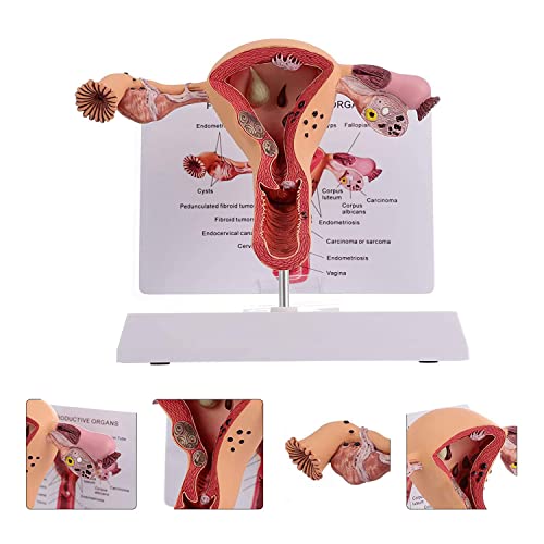 Menschliches pathologisches weibliches Uterusmodell, internes Fortpflanzungssystem, Organanatomisches Modell, menschlich Menschliches pathologisches weibliches Uterusmodell, internes Fortpflanzungssystem, Organanatomisches Modell, menschlich von Generic