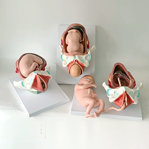 Schwangerer Embryo, weiblicher Begriff, Fötus, Entbindungsprozess, Geburt, Fötus, Baby, dreiteiliges Set, Geburtshilfe u von Generic