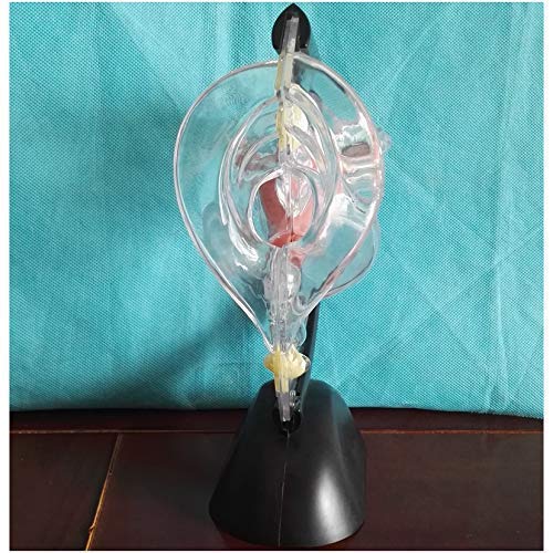 Transparentes Modell des pathologischen Uterus-Fortpflanzungssystems – Anatomisches Modell eines menschlichen Organs. Ut von Generic
