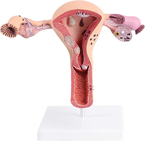Weibliches pathologisches Uterusmodell, vaginales Eierstock-Lehrmittel, Pathologie-Lehrmittel, Simulation des menschlich Weibliches pathologisches Uterusmodell, vaginales Eierstock-Lehrmittel, Pathologie-Lehrmittel, Simulation des menschlich von Generic