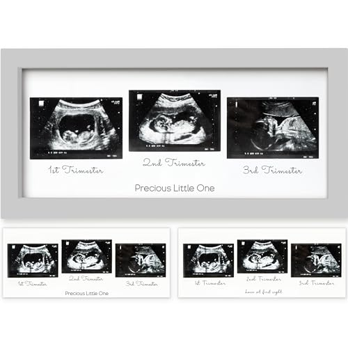 Trio Baby Bilderrahmen für Ultraschallbilder - Bilderrahmen Ultraschallbild Baby, Ultraschall Bilderrahmen Schwangerschaft, Ultraschallbilder Rahmen, Geschenke für Werdende Mamas (Cloud Gray) von KeaBabies