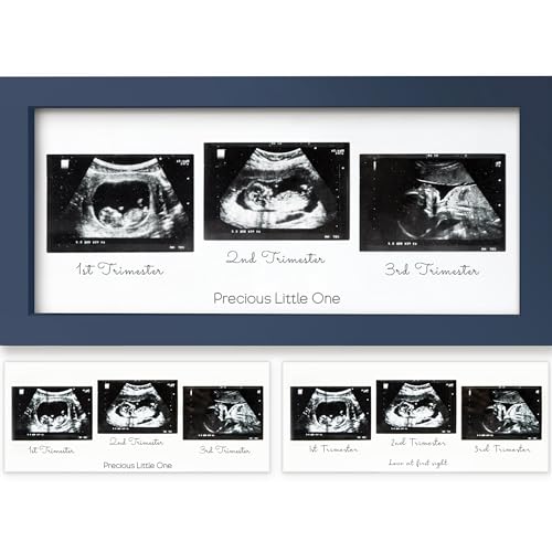 Trio Baby Bilderrahmen für Ultraschallbilder - Bilderrahmen Ultraschallbild Baby, Ultraschall Bilderrahmen Schwangerschaft, Ultraschallbilder Rahmen, Geschenke für Werdende Mamas (Midnight Blue) von KeaBabies