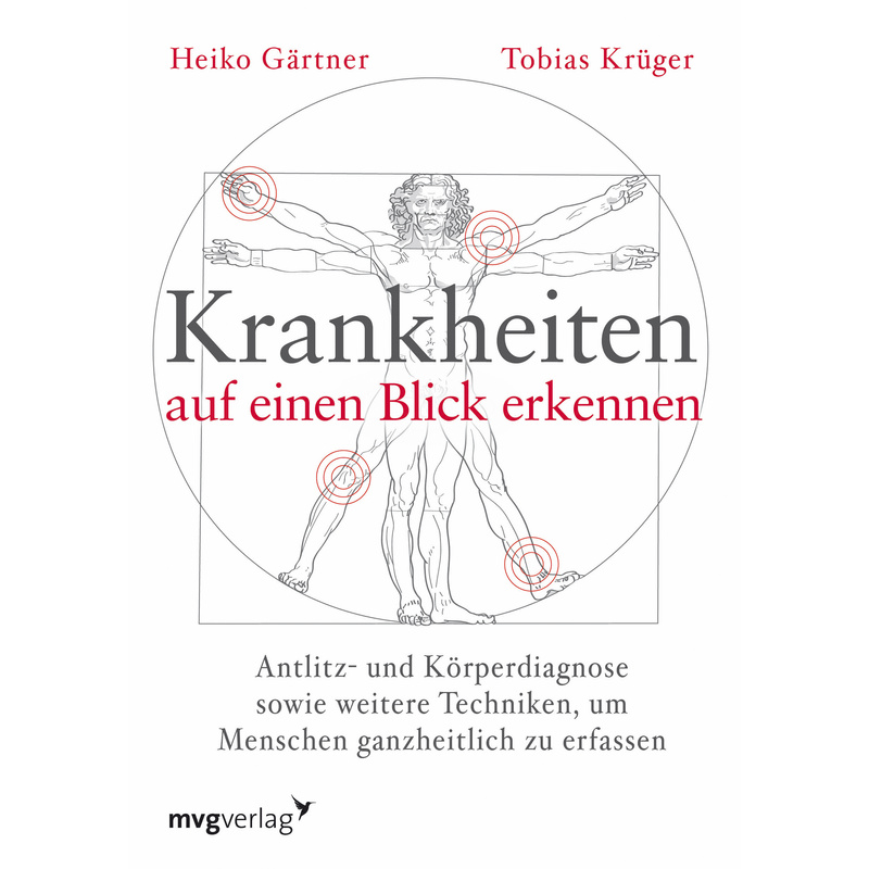 Krankheiten Auf Einen Blick Erkennen - Heiko Gärtner, Tobias Krüger, Kartoniert (TB) von MVG VERLAG