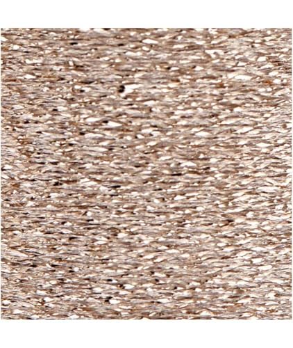Rico Design Stickgarn - Metallicfarbe - Champagne von Rico Design
