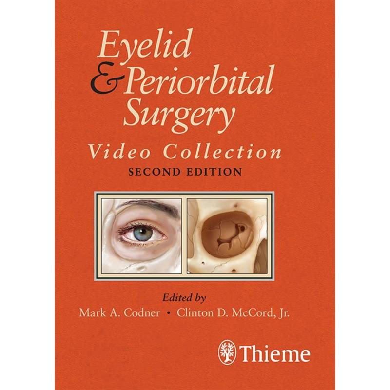 Eyelid And Periorbital Surgery, 1 Usb-Stick von Thieme, Stuttgart