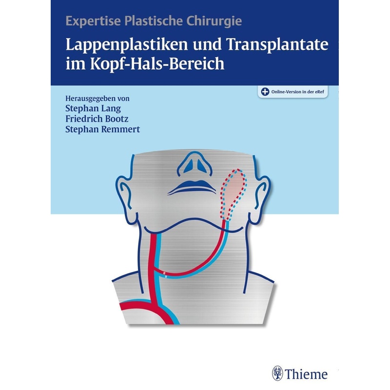 Lappenplastiken Und Transplantate Im Kopf-Hals-Bereich, Gebunden von Thieme