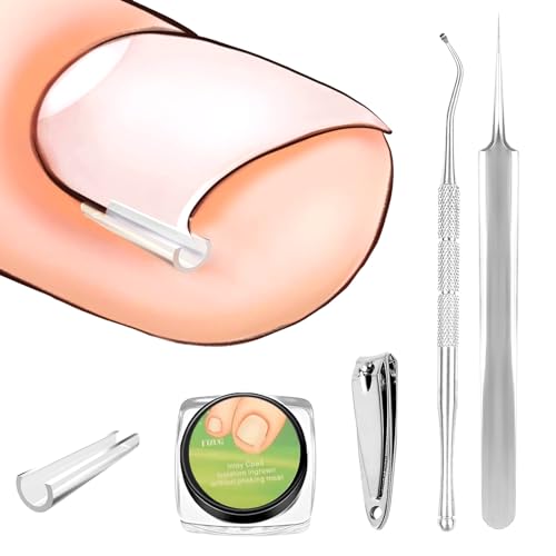 60 Stück Eingewachsene Zehennägel Set, Xerteam Zehennagelkorrektur für Eingewachsene Zehennägel, Zehennagel Korrektur Patch, Korrektor Pediküre Werkzeugen Mit Nagelknipser, Nagelzange, Pinzette von Xerteam